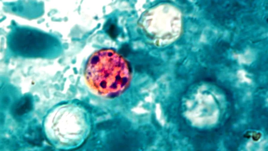 Cyclospora What We Know and Don’t Know Growing Produce